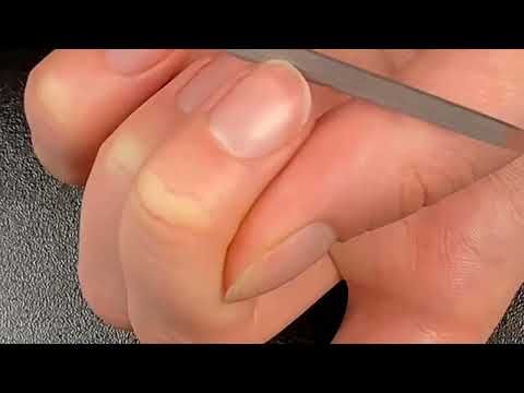 Load image into Gallery viewer, Erbe solingen saffiervijl 15cm (erbe91805)